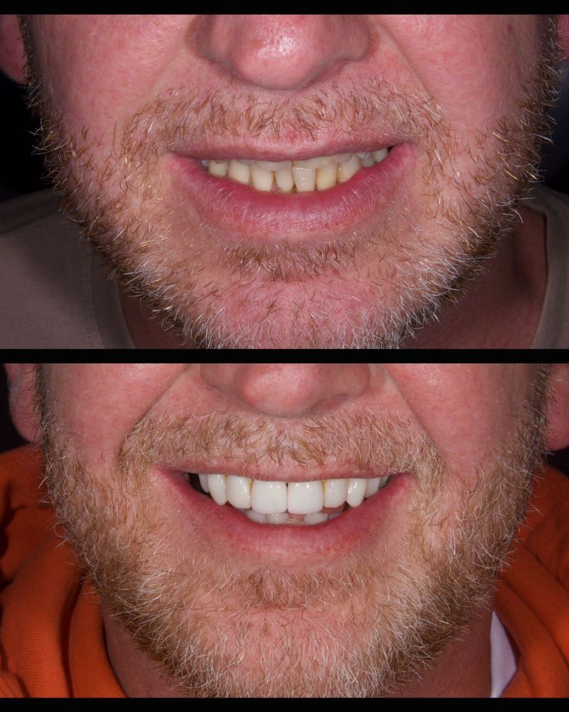 Before & after treatment with Nial