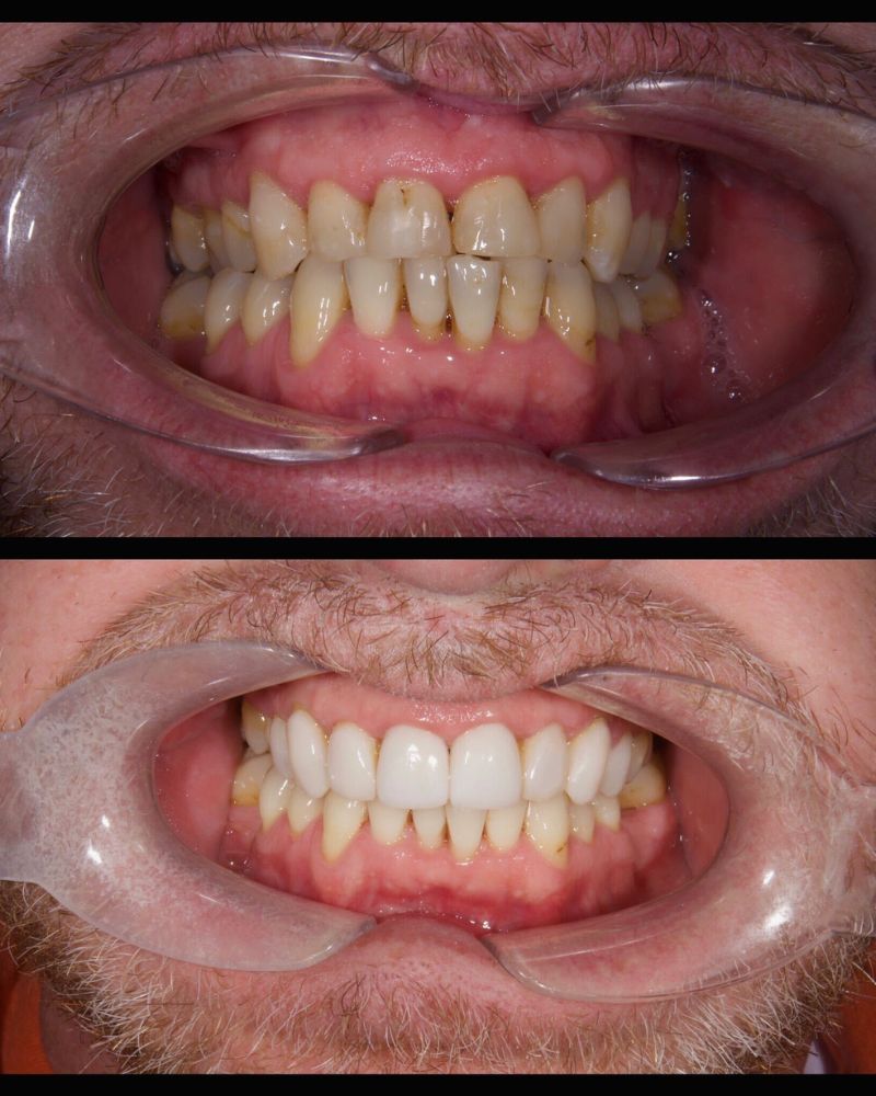 Before & after treatment with Nial