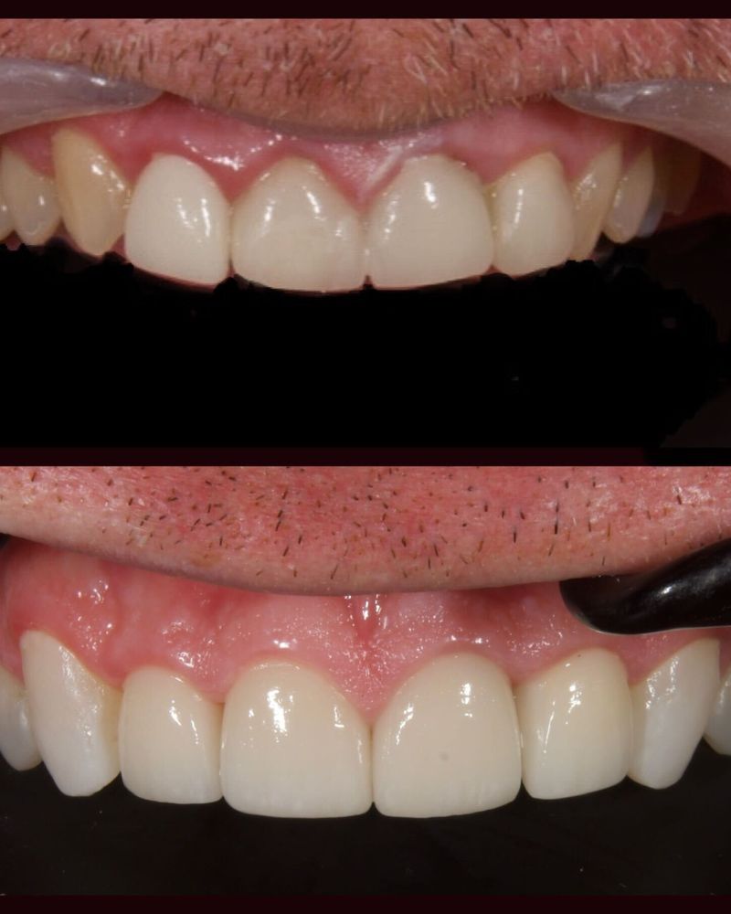 Before & after treatment with Nial