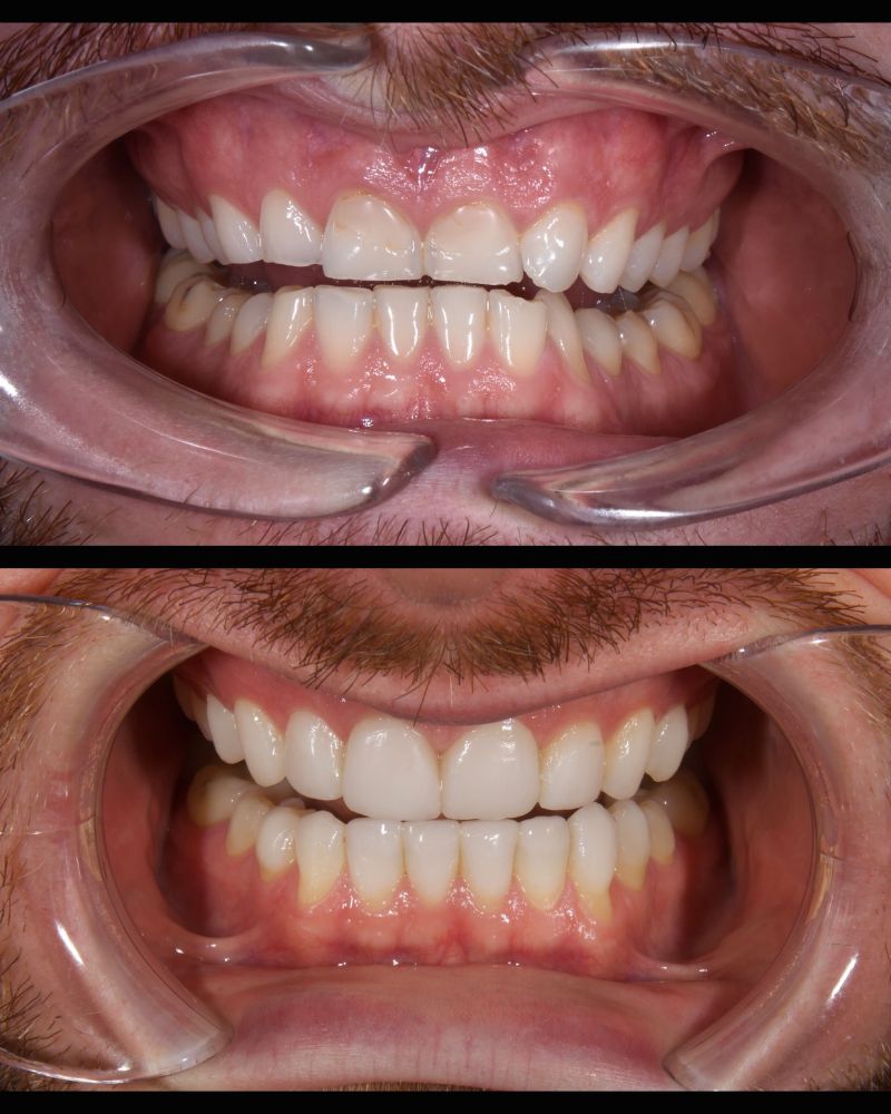 Before & after treatment with Nial