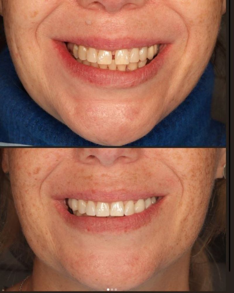 Before & after treatment with Morven