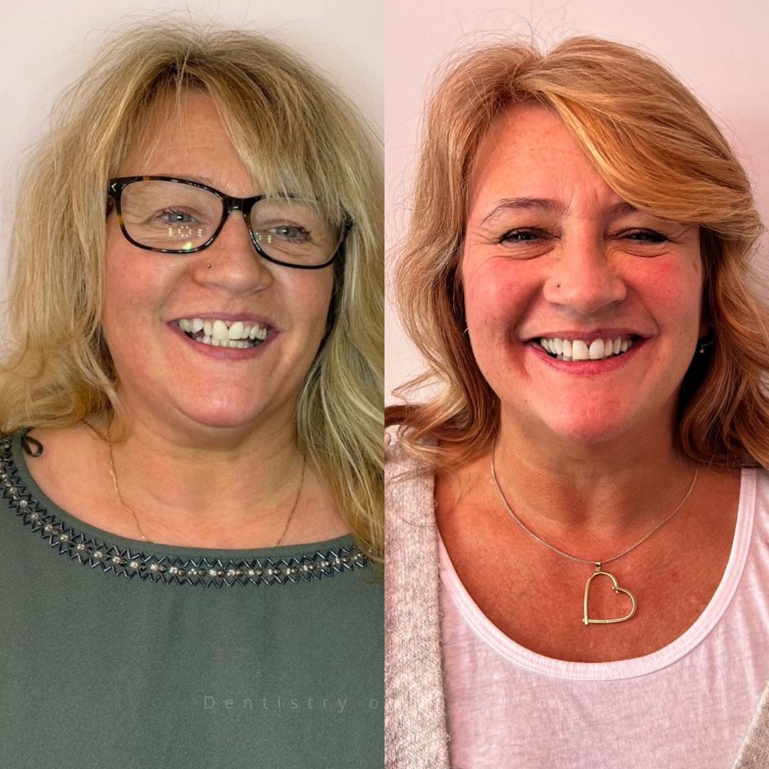 Before and after treatment