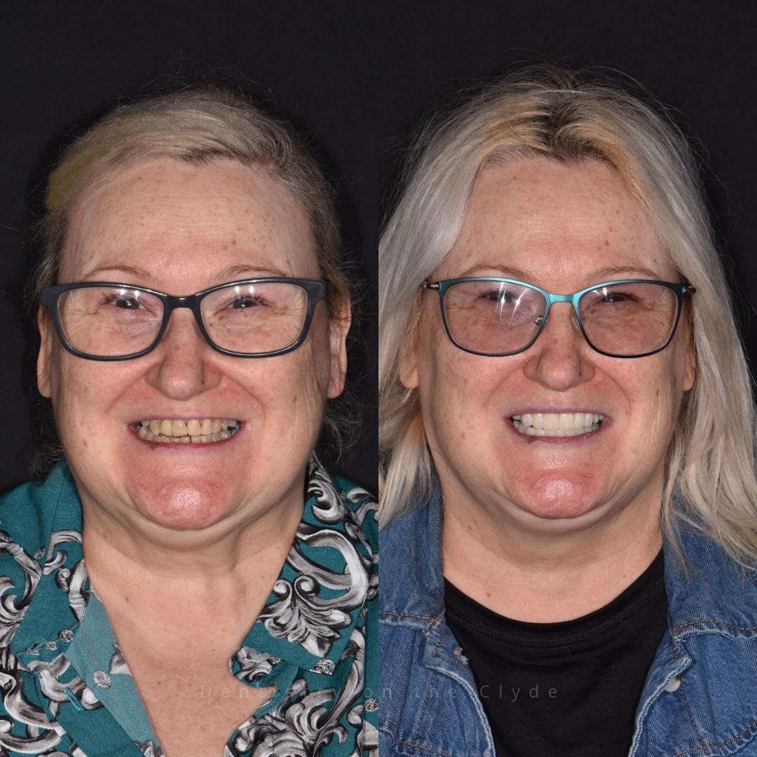 Before and after treatment