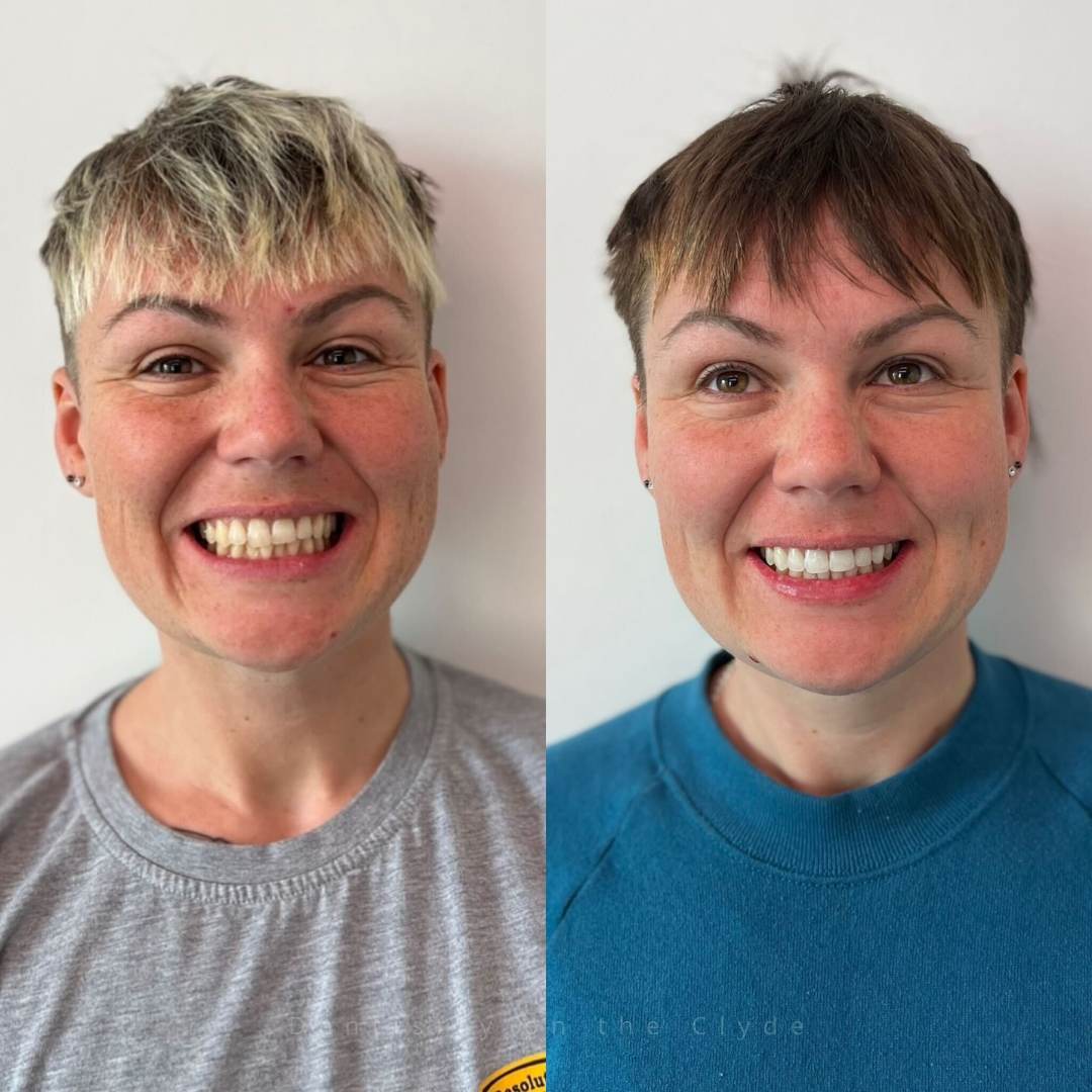 Before and after treatment
