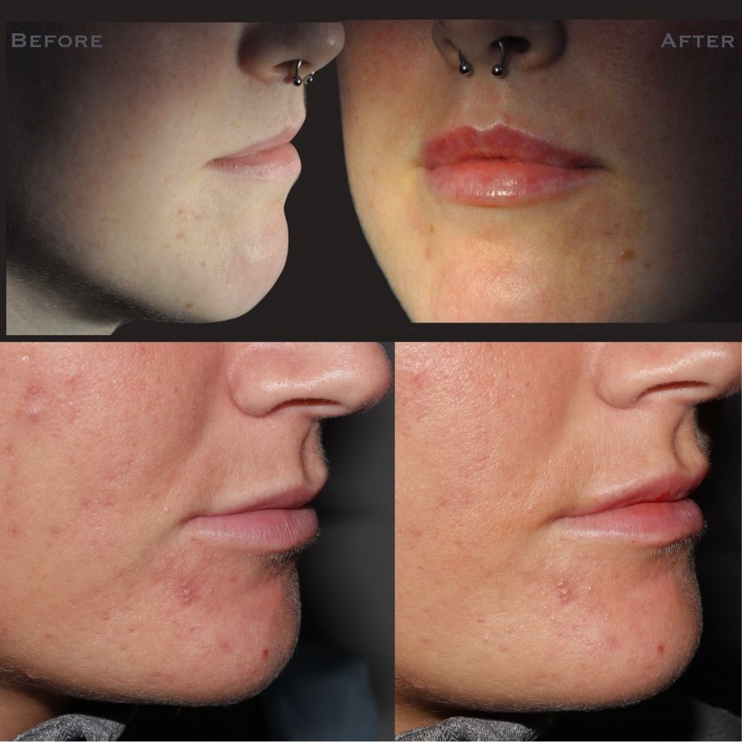 Dentistry On The Clyde | Face And Beauty Before and after treatment