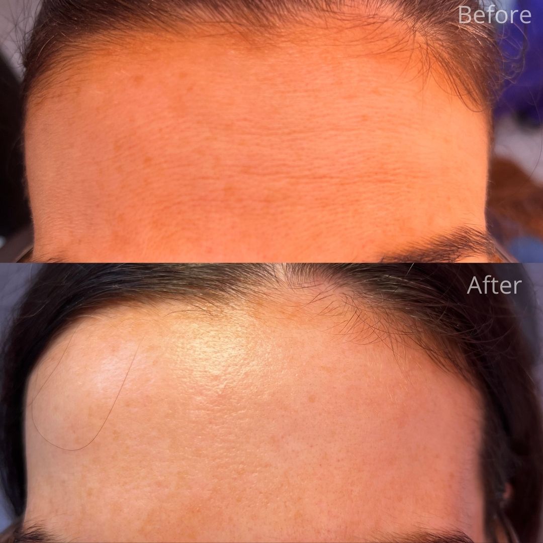 Dentistry On The Clyde | Face And Beauty Before and after treatment