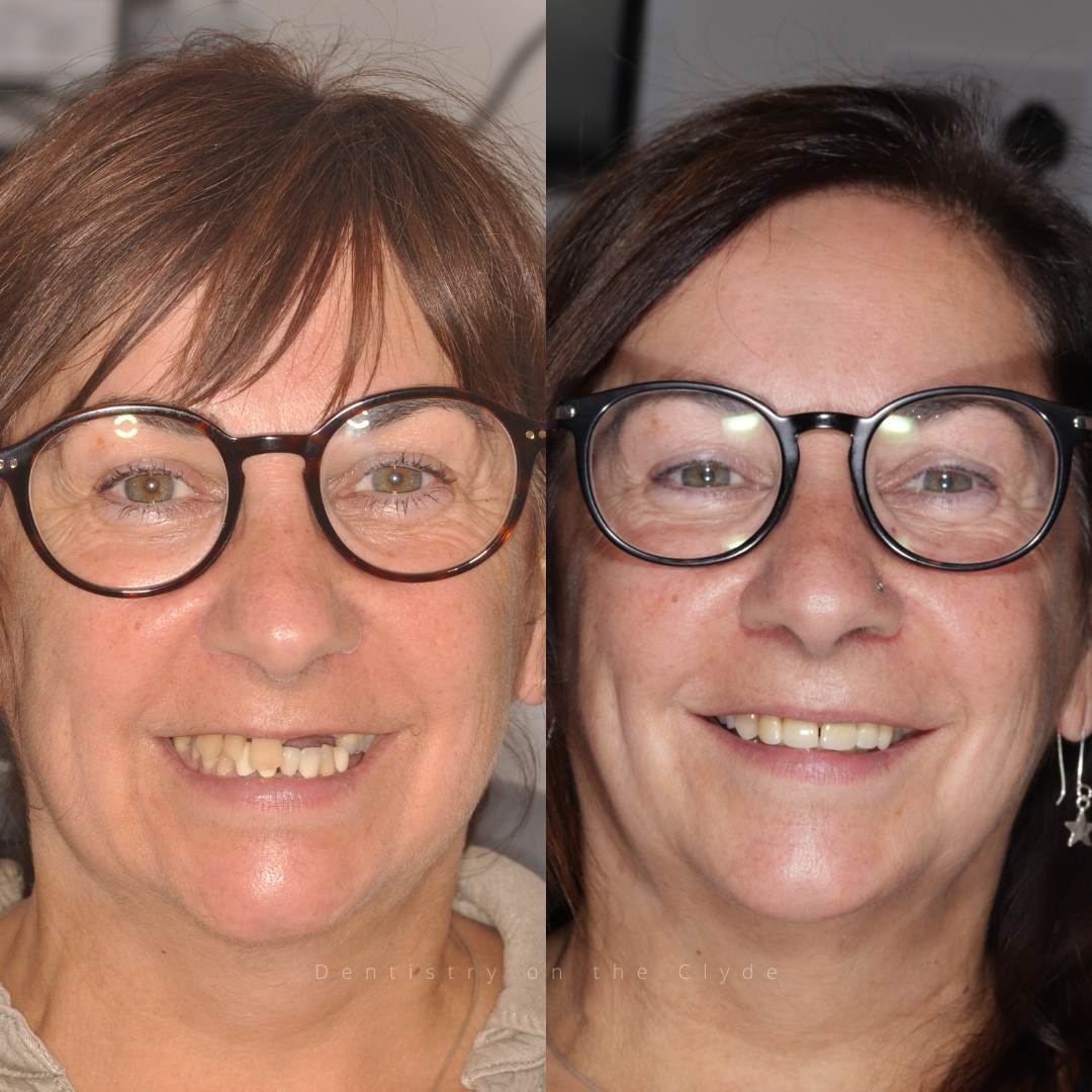 Before and after treatment