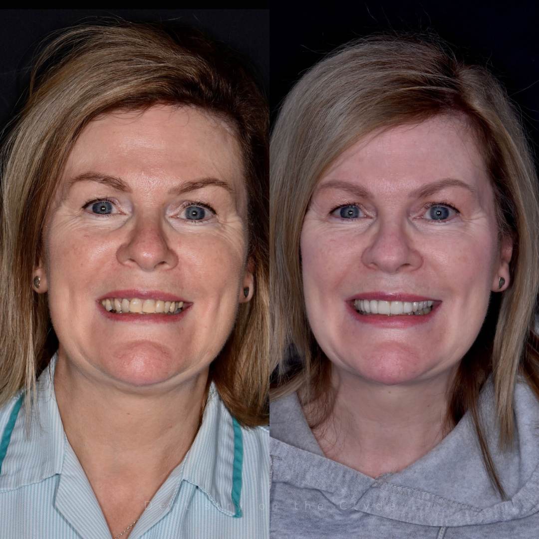 Before and after treatment