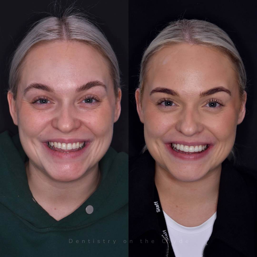 Before and after treatment