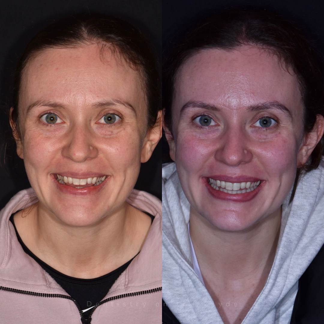 Before and after treatment