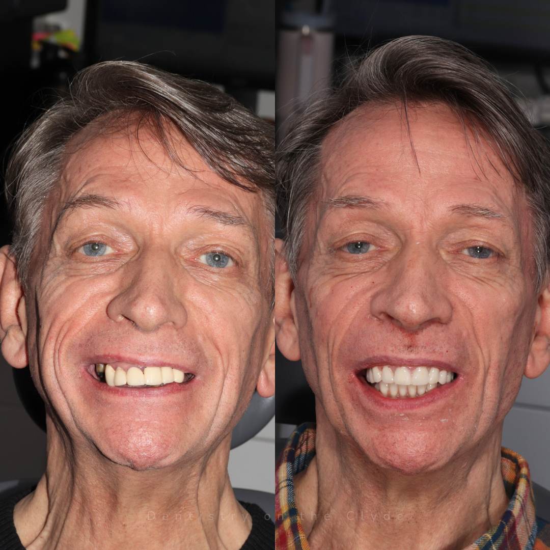 Before and after treatment