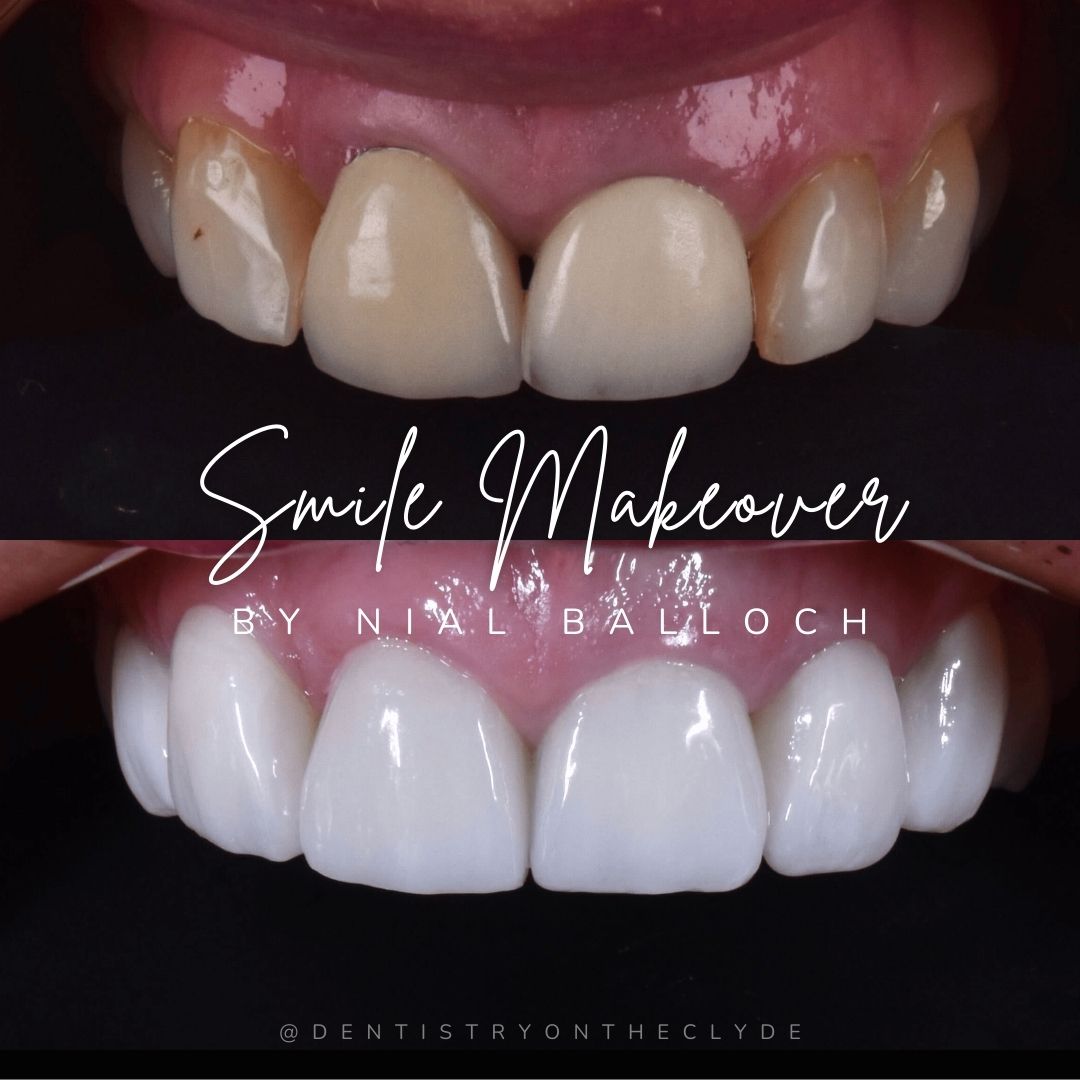 FAQs Frequently Asked Questions Dentistry On The Clyde