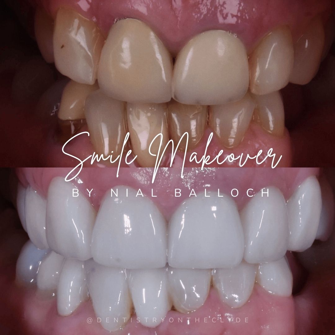 Dentistry On The Clyde | Smile Makeovers Dentistry On The Clyde | Smile Makeovers