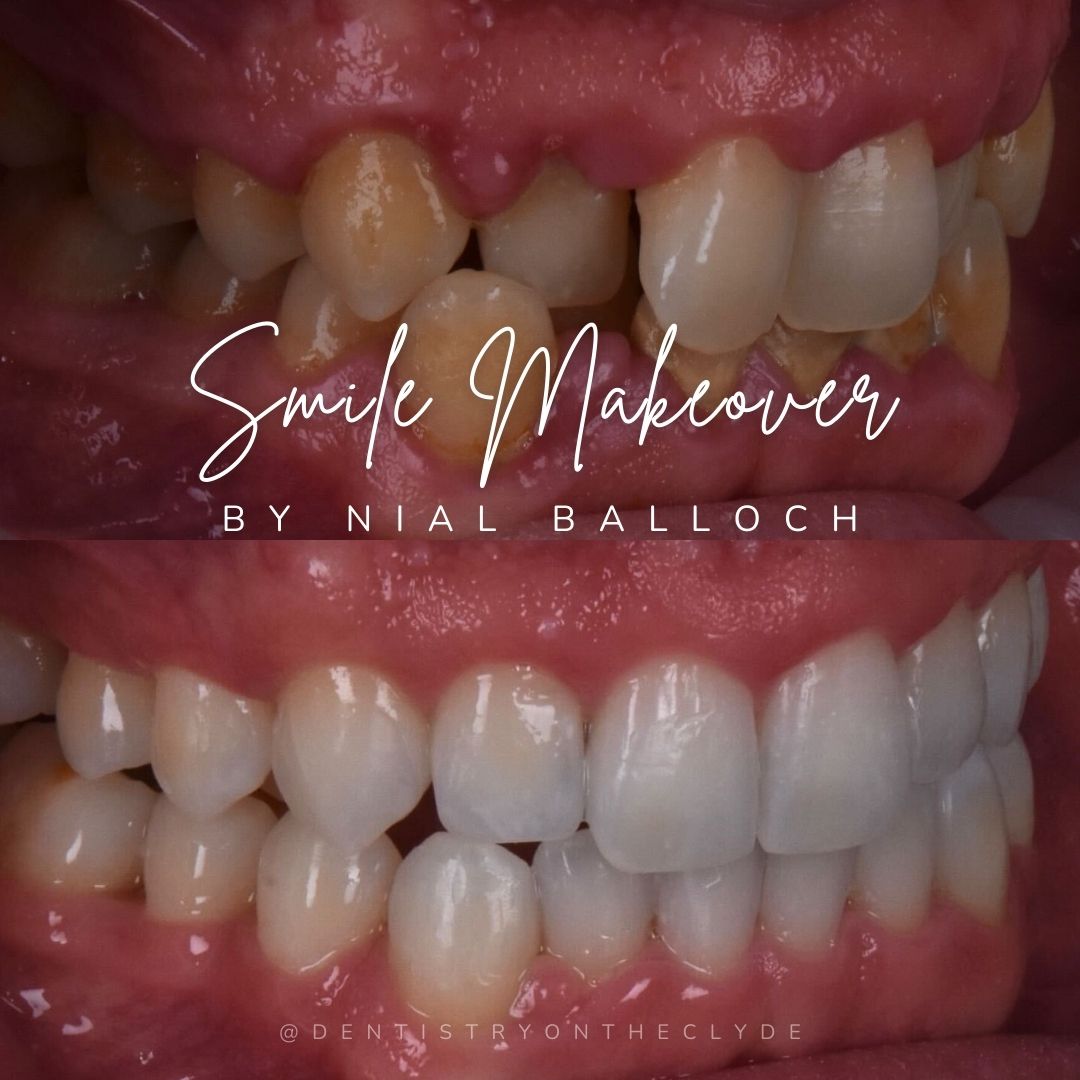 Dentistry On The Clyde | Smile Makeovers Dentistry On The Clyde | Smile Makeovers