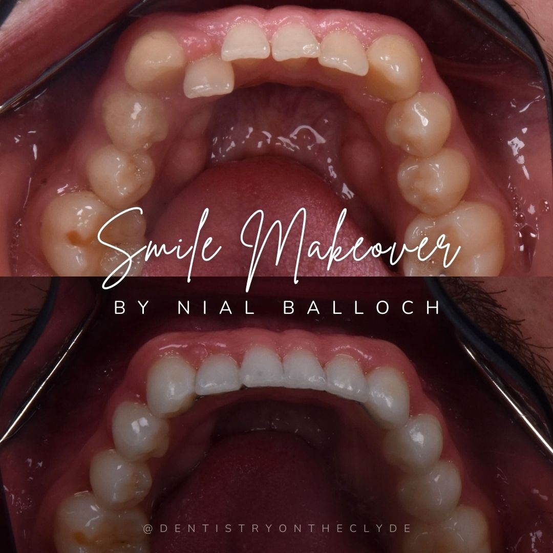 Dentistry On The Clyde | Smile Makeovers