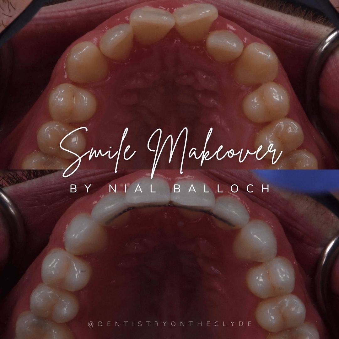 Dentistry On The Clyde | Smile Makeovers Dentistry On The Clyde | Smile Makeovers