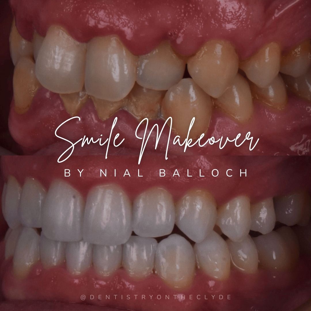 Dentistry On The Clyde | Smile Makeovers