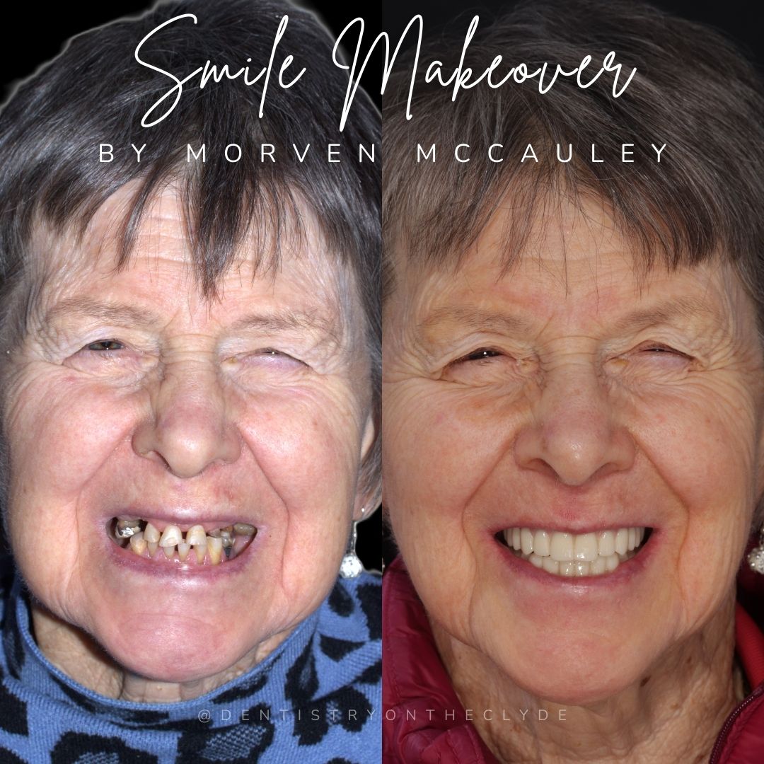 Dentistry On The Clyde | Pain Free Dentist In Gourock