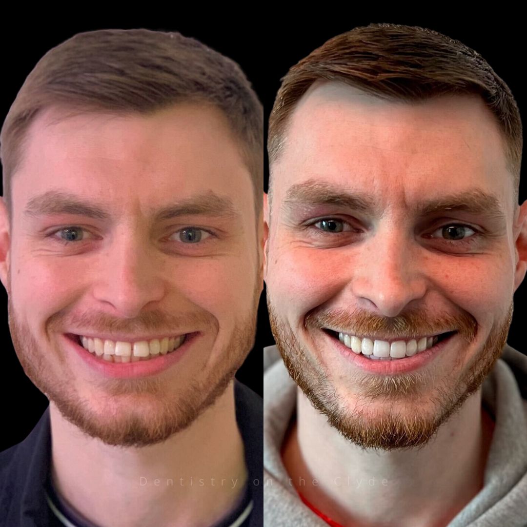 Dentistry On The Clyde | Pain Free Dentist In Gourock