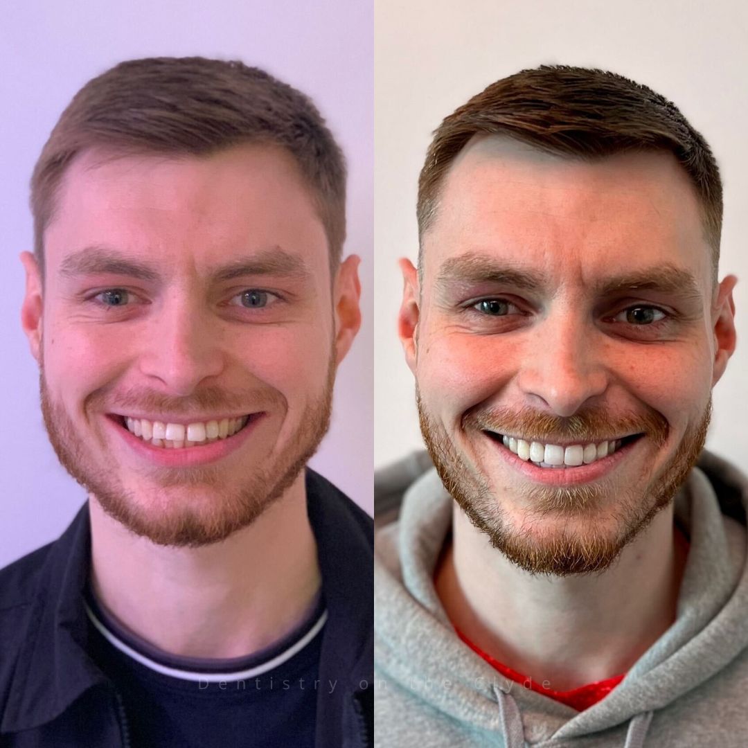 Dentistry On The Clyde | Pain Free Dentist In Gourock