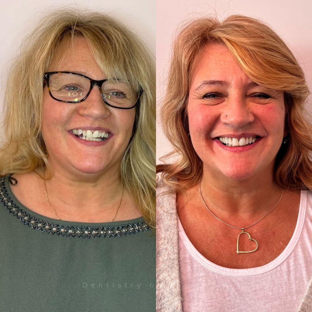 Dentistry On The Clyde | Pain Free Dentist In Gourock