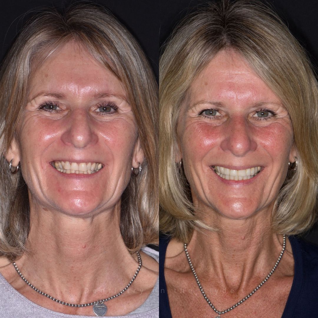 Dentistry On The Clyde | Pain Free Dentist In Gourock