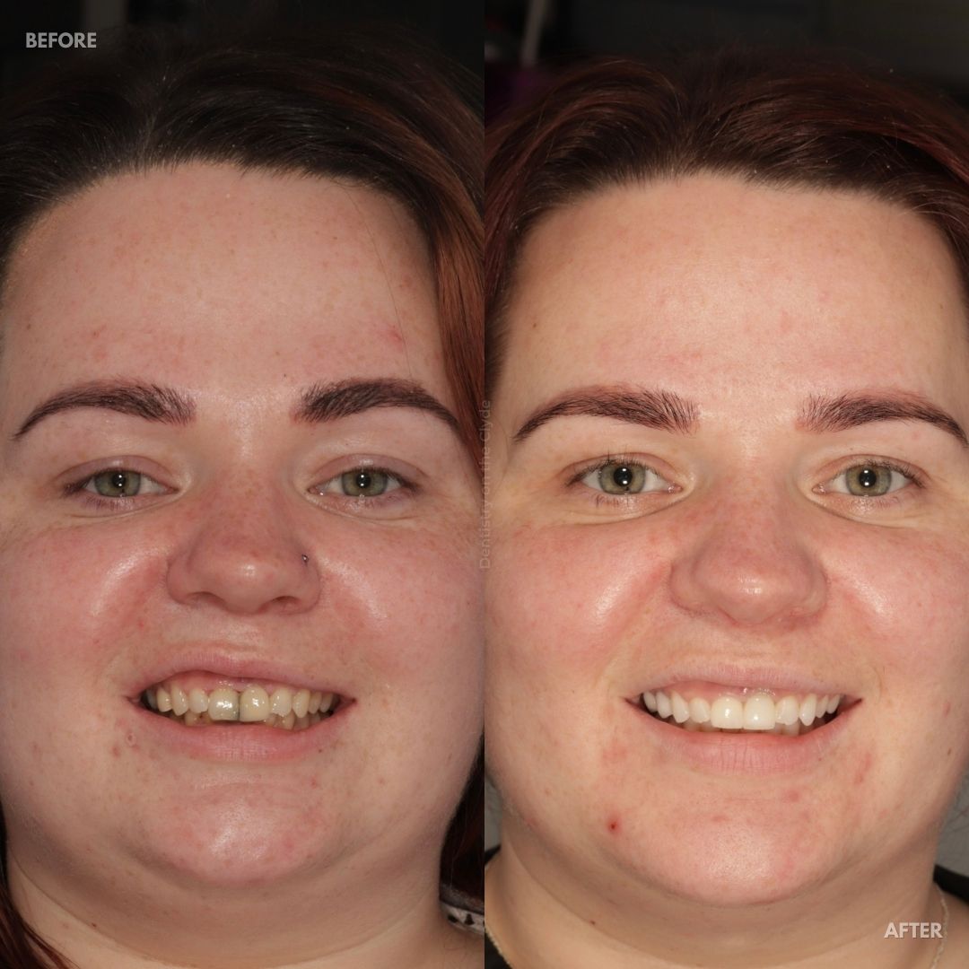 Dentistry On The Clyde | Pain Free Dentist In Gourock
