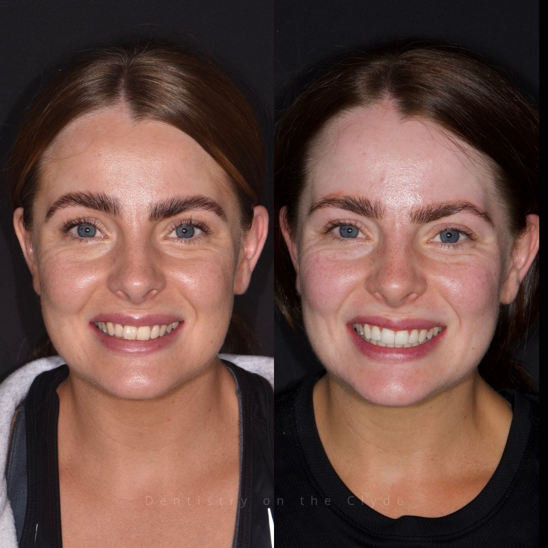 Dentistry On The Clyde | Pain Free Dentist In Gourock