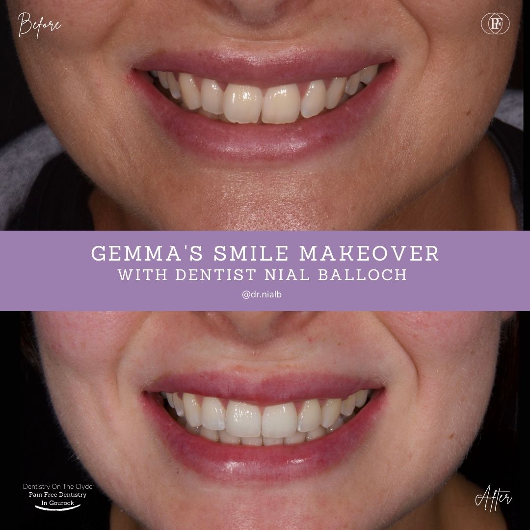 Dentistry On The Clyde | Gemma's Smile Story