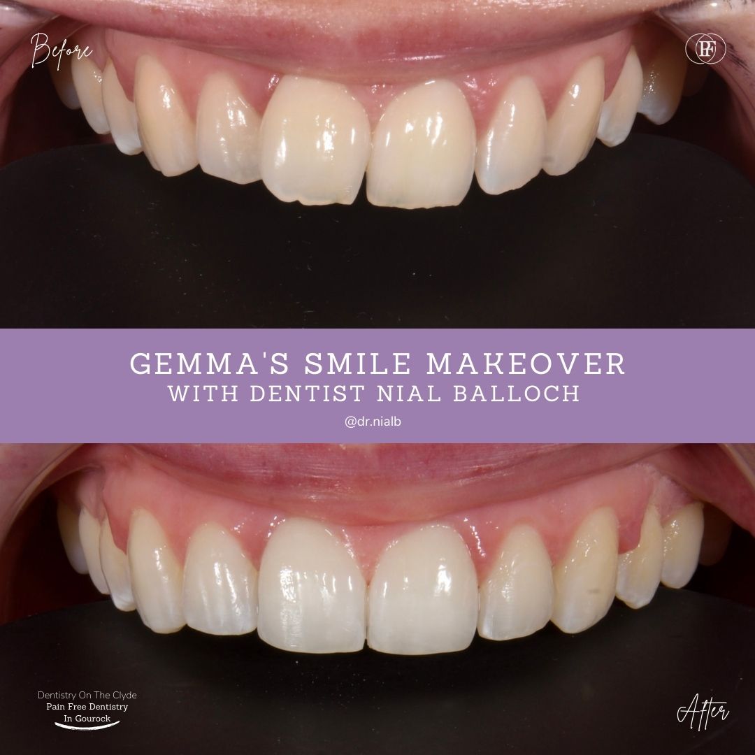 Dentistry On The Clyde | Gemma's Smile Story