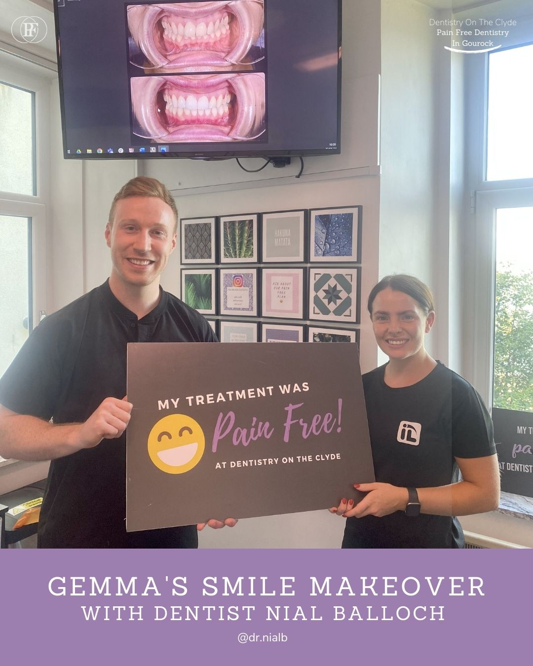 Gemma's Smile Story with Nial