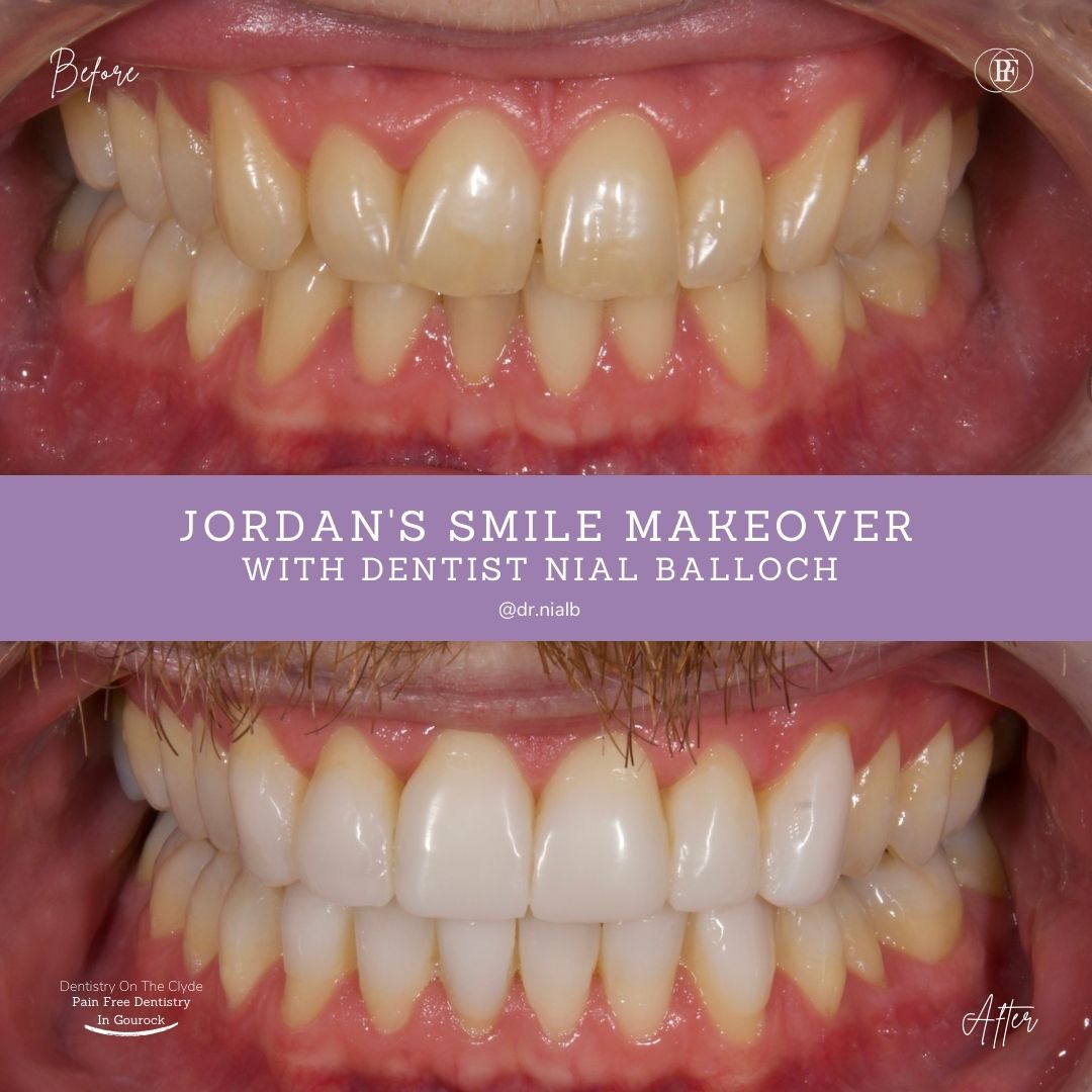 Dentistry On The Clyde | Jordan's Smile Story