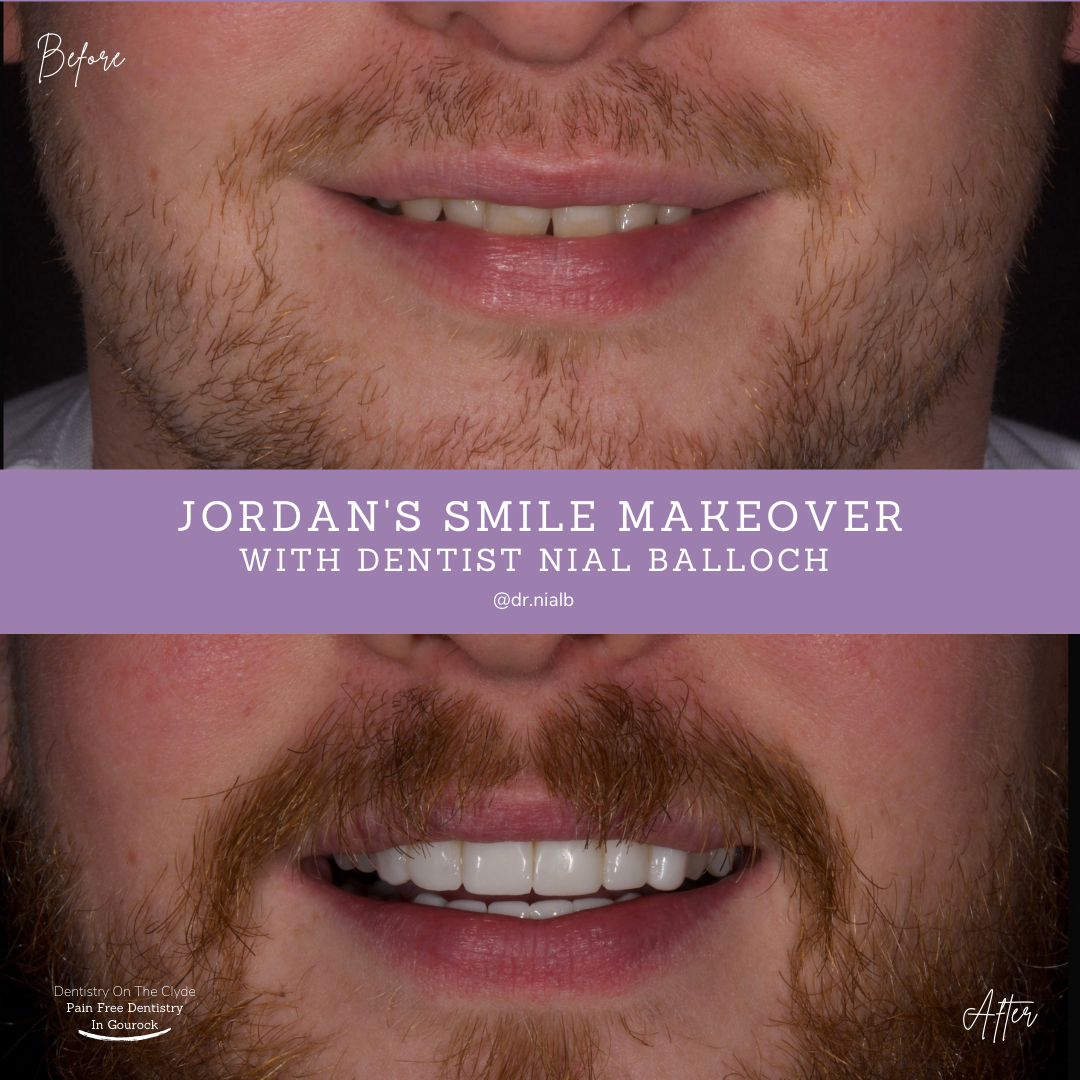 Jordon's Smile Story with Nial