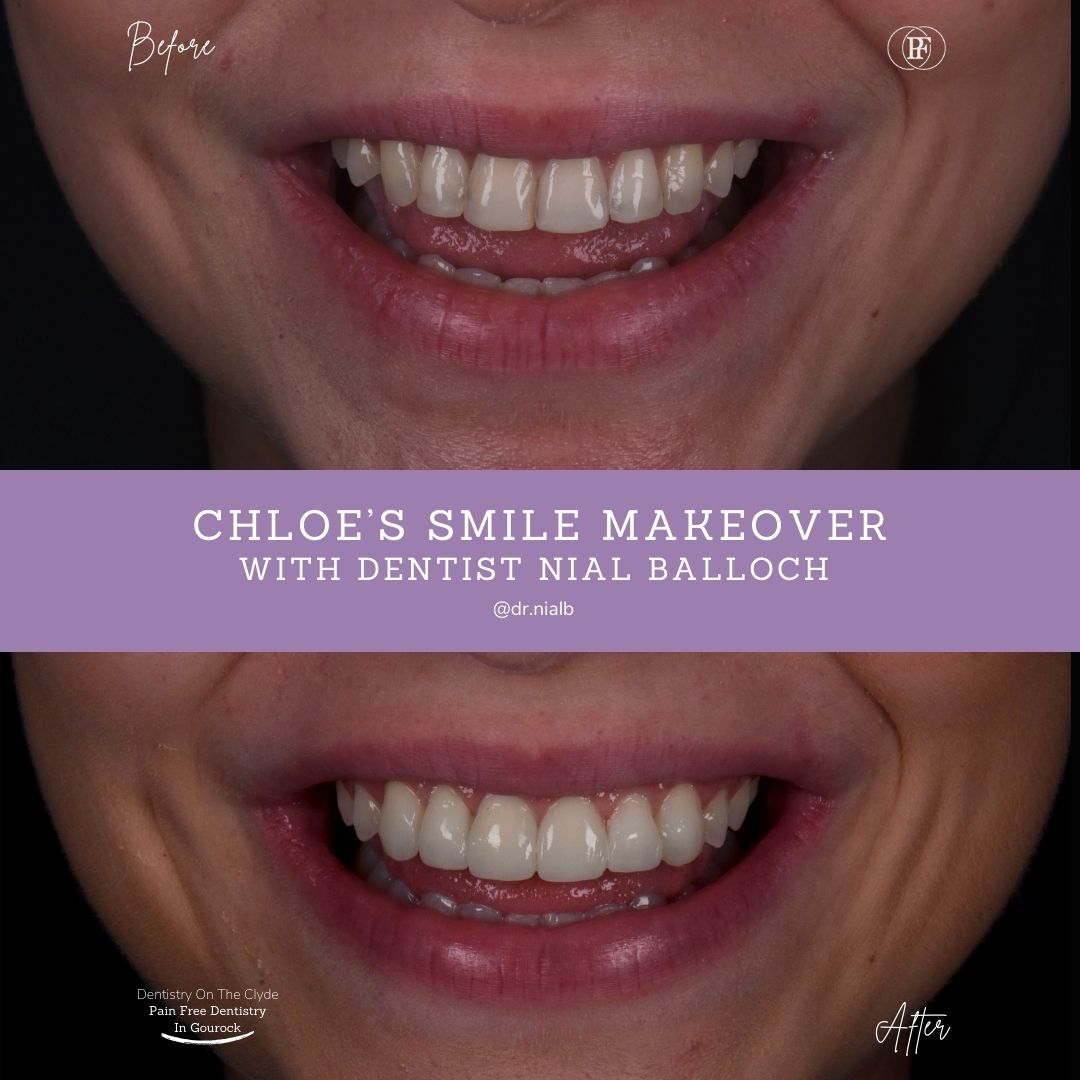 Chloe's Smile Story with Nial
