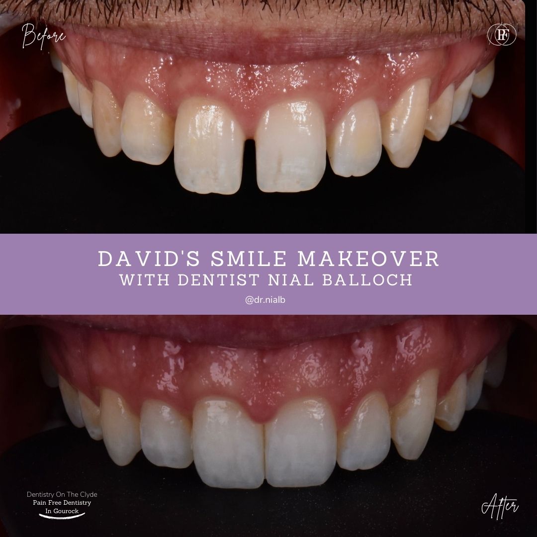 Dentistry On The Clyde | David's Smile Story