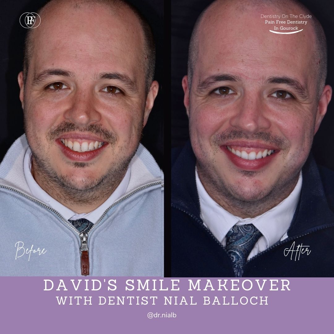 Dentistry On The Clyde | David's Smile Story