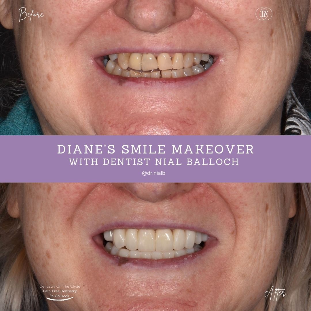 Diane's Smile Story with Nial