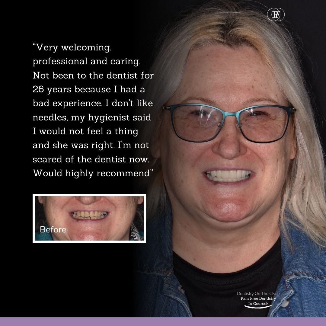 Diane's smile story