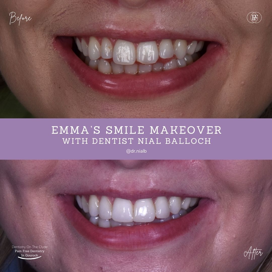Emma's smile story with Nial