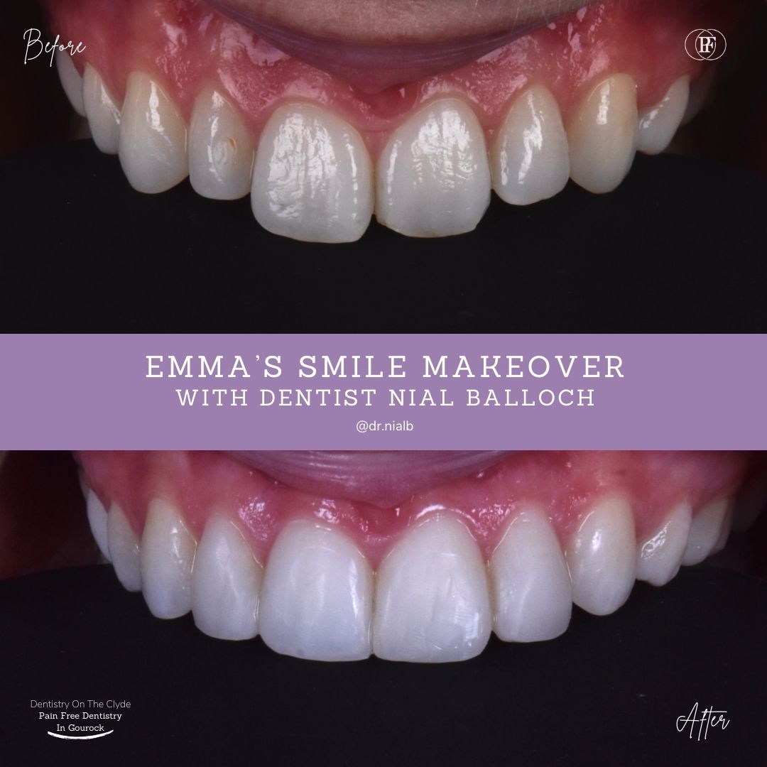 Dentistry On The Clyde | Emma's Smile Story