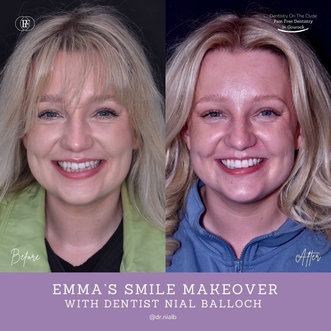 Dentistry On The Clyde | Emma's Smile Story