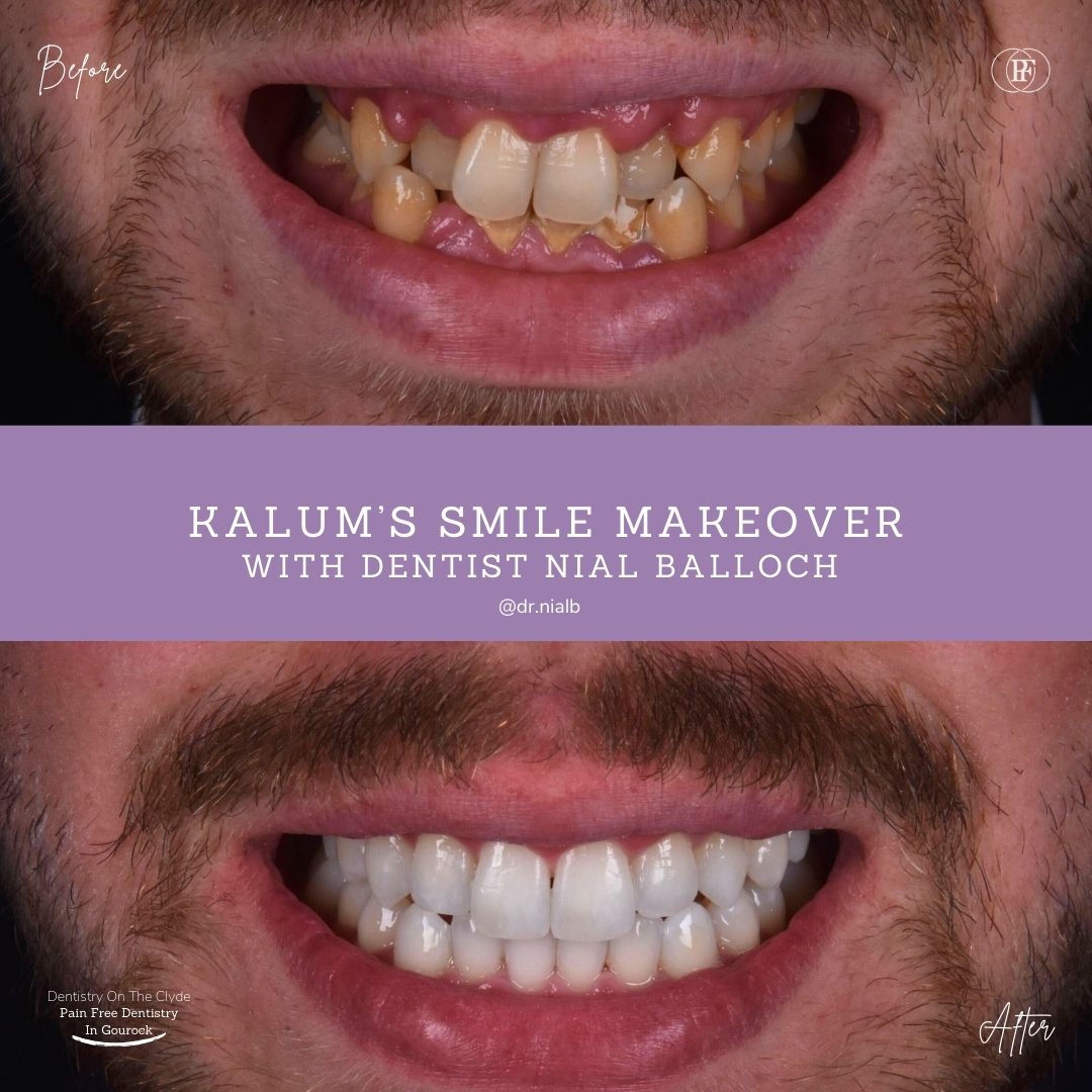 Kalum's Smile Story with Nial