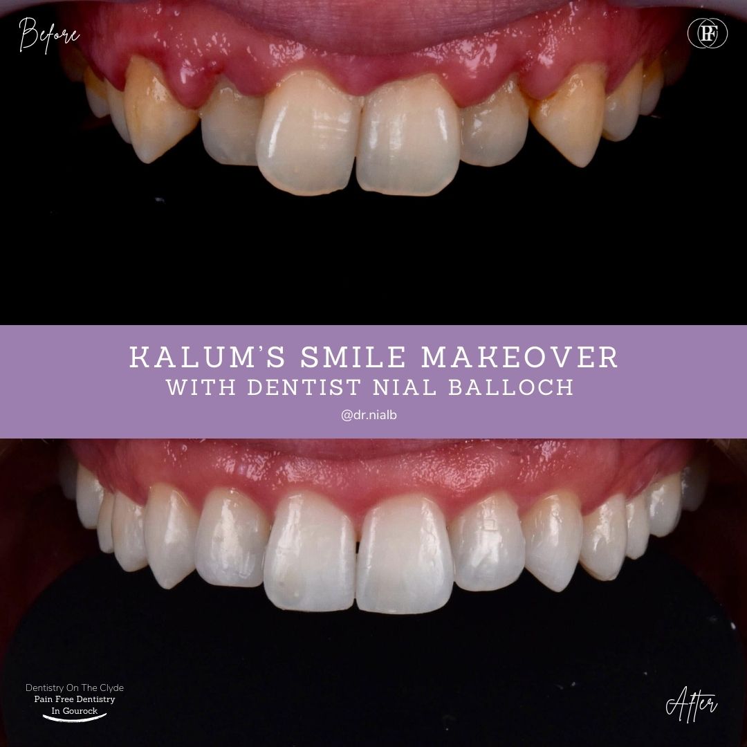 Dentistry On The Clyde | Kalum's Smile Story