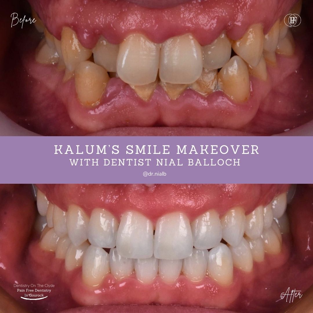 Dentistry On The Clyde | Kalum's Smile Story