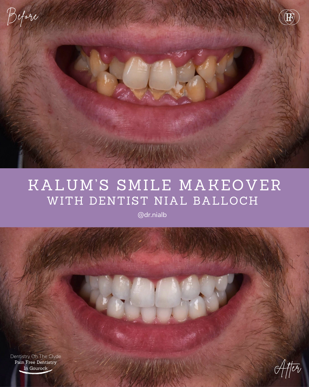 Dentistry On The Clyde | Kalum's Smile Story