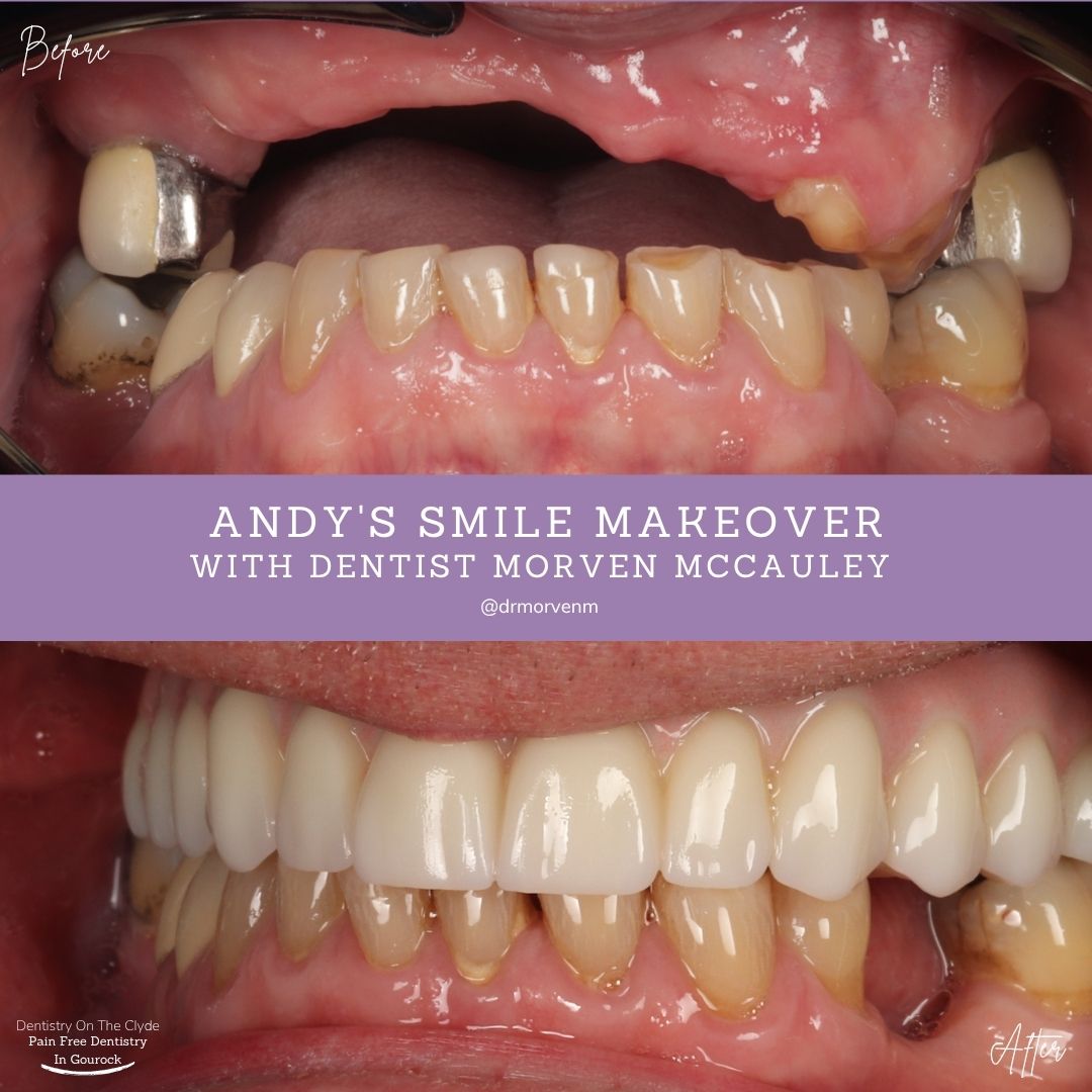 Dentistry On The Clyde | Andy's Smile Story