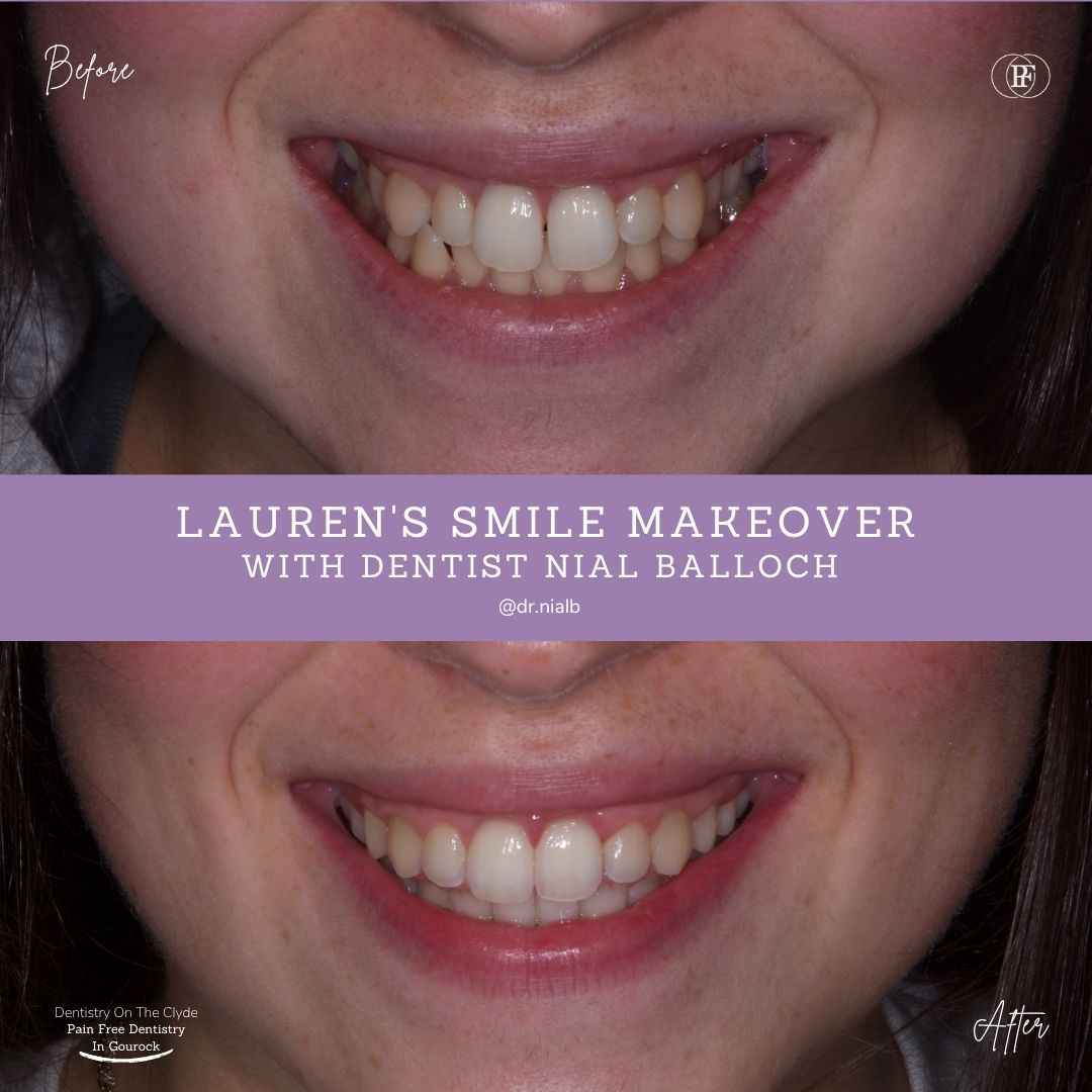 Dentistry On The Clyde | Lauren's Smile Story