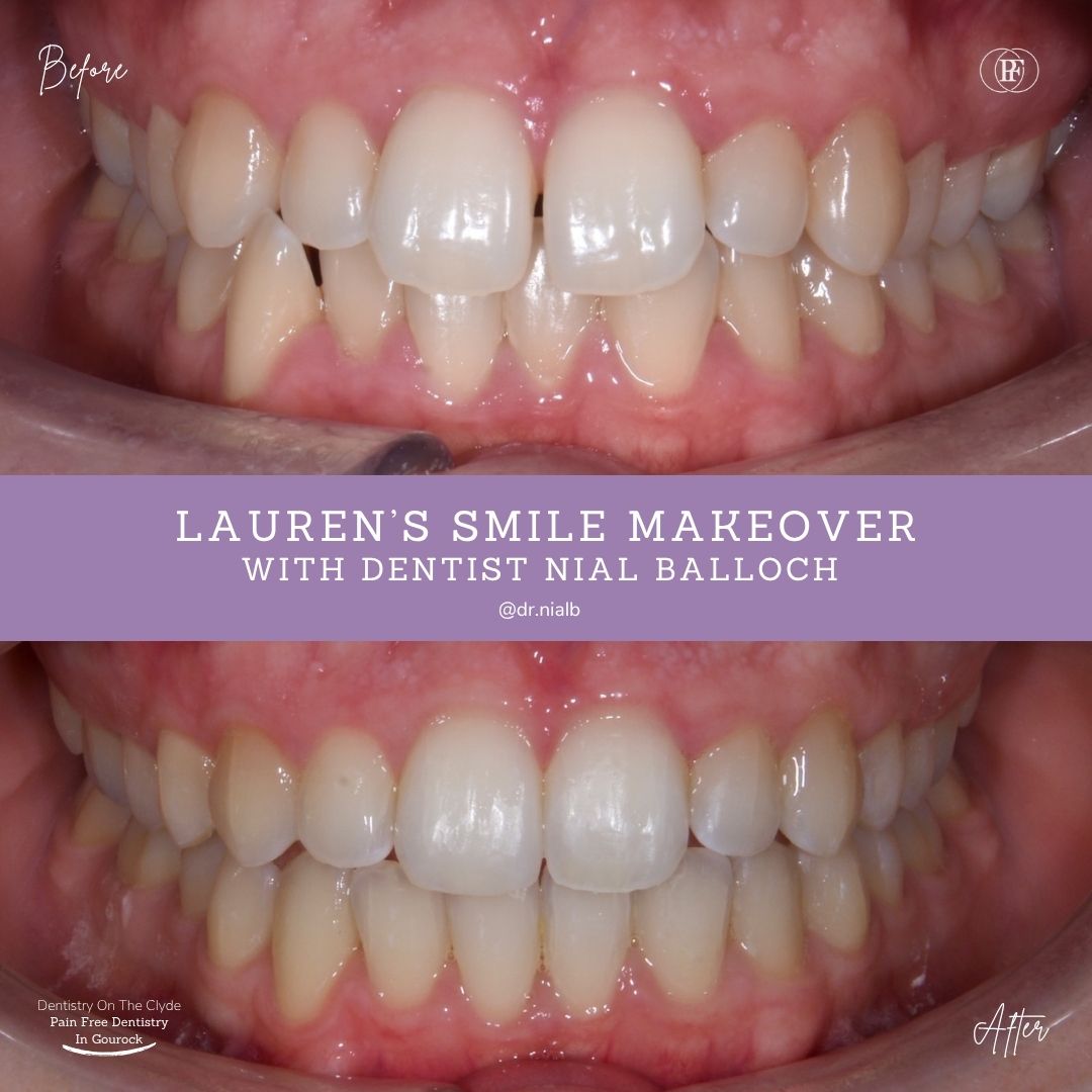 Lauren's Smile Story with Nial