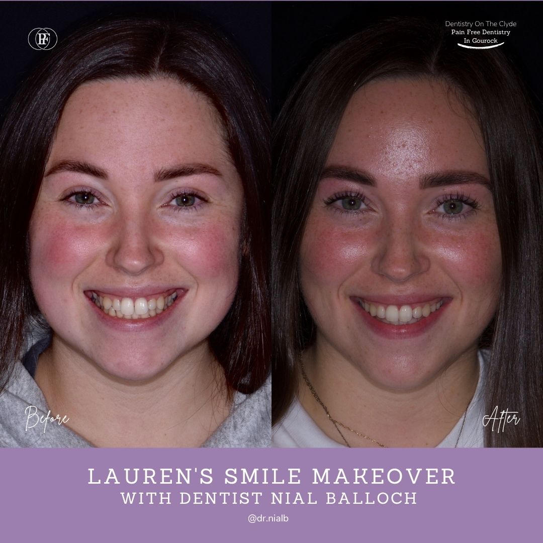 Dentistry On The Clyde | Patient Stories
