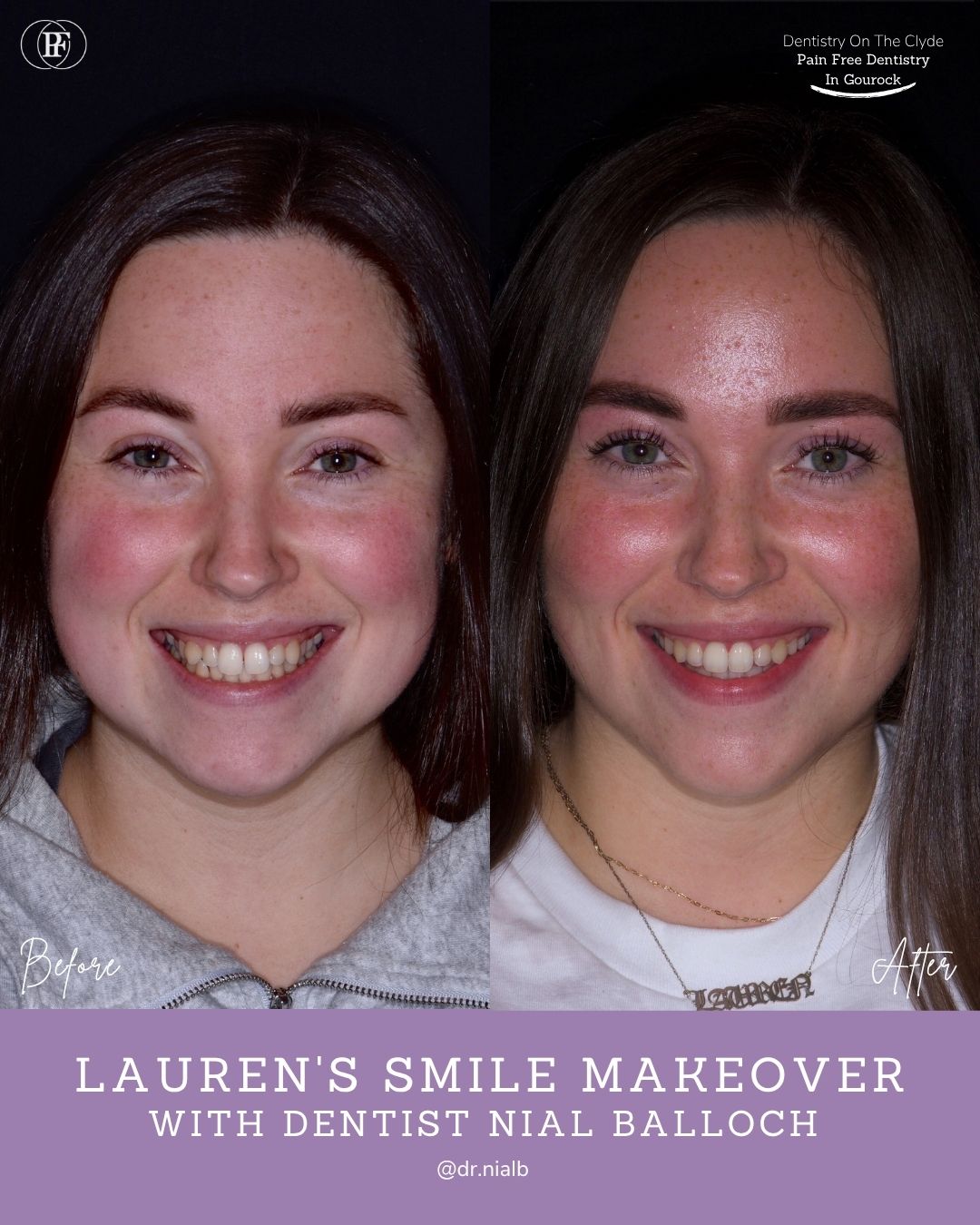Lauren's Smile Story with Nial